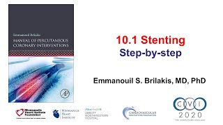 101 Manual of PCI  How to perform stenting [upl. by Solana]