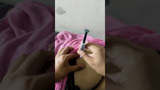 injection video ll injection viral video ll intramuscular injection procedure ll intramuscular llll [upl. by Randal]