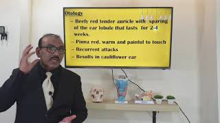 Relapsing polychondritis Malayalam Patient teaching programme [upl. by Lacagnia]