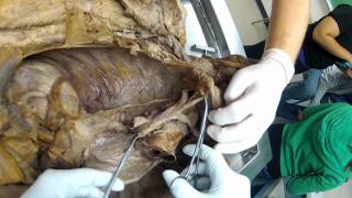 Fall 2012 Thoracic Vasculature Overview [upl. by Onateyac]