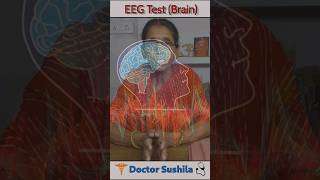 EEG Test for Brain 🧠 🧐  EEG Test kya hota hai  A simple explanation  shorts braintest [upl. by Maure]