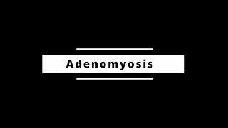 Adenomyosis [upl. by Ahsemak]