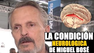 ¿Qué es la sinestesia condición neurológica con la que vive Miguel Bosé [upl. by Newmark659]