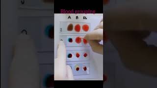 Blood grouping by slide method shorts abobloodgroup [upl. by Ratna]