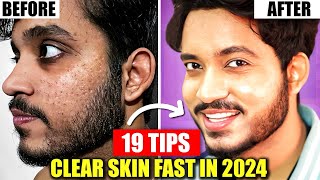 19 Hacks To Get Clear Skin Fast In 2024  Skin Glow up For Indian Boys amp Men [upl. by Aihtnis]