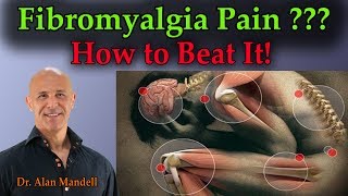 Fibromyalgia Pain How To Beat It  Dr Mandell [upl. by Norrabal]