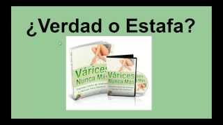 Libro Varices Nunca Mas  ¿ESTAFA [upl. by Rahel]