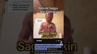 Saggy Skin Solution [upl. by Culhert]