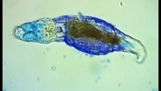 Observations of a bdelloid rotifer ending with full methylene blue reactiondeath [upl. by Nhaj]