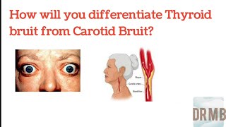 Difference between Thyroid Bruit and Carotid Bruit  How to differentiate Dr M B [upl. by Rehpotsirk]