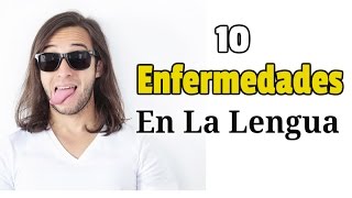 10 Enfermedades En La Lengua Imagenes [upl. by Ahsok]