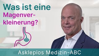 Was ist eine Magenverkleinerung  Medizin ABC  Asklepios [upl. by Dnalyag669]