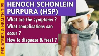 Henoch Schonlein Purpura HSP Causes Symptoms Diagnosis amp Treatment In Pediatrics [upl. by Goss]