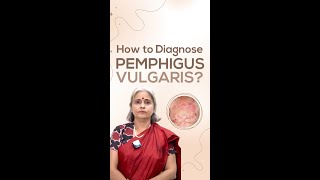 How to Diagnose Pemphigus Vulgaris [upl. by Flynn]