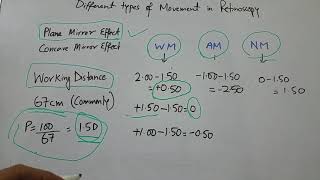 Different types of movement in Retinoscopy [upl. by Thais]