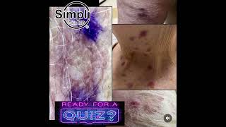 Dermatology Quiz Time [upl. by Atsed]