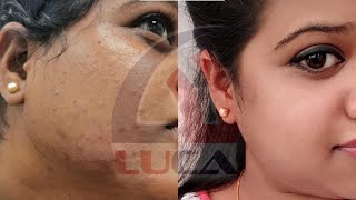 LUCA MIXING FACE WHITENING CREAM MALAYALAM REVIEW  CONTACT  7012038148 [upl. by Salaidh]