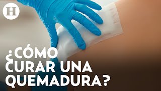 ¿Cómo actuar en caso de quemadura Rodrigo Mata nos comparte tips para reaccionar en esta emergencia [upl. by Adnara]