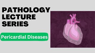 Pericardial Effusion  Cardiac Tamponade  Pericarditis  Pathology Lecture Series  Lecture 8 [upl. by Nomolas426]