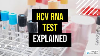 HCV RNA Test explained [upl. by Evaleen300]