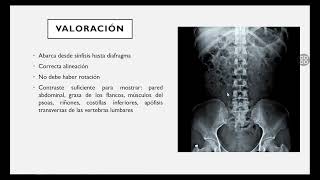 RADIOGRAFIA SIMPLE DE ABDOMEN [upl. by Isleen]