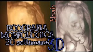 Video Ecografia MORFOLOGICA in 3D 20 settimane di gravidanza💙 Noah💙 [upl. by Noswal]