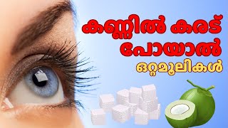 കണ്ണിൽ കരട് പോയാൽ ചെയ്യാൻ പറ്റുന്ന ഒറ്റമൂലികൾ  kannil karadu poyal ottamooli homeremedies tips [upl. by Guibert8]