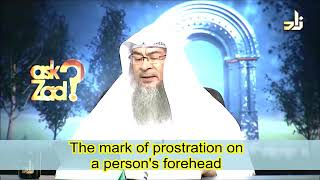 Mark of prostration on a persons forehead  Sheikh Assim Al Hakeem [upl. by Amitaf]