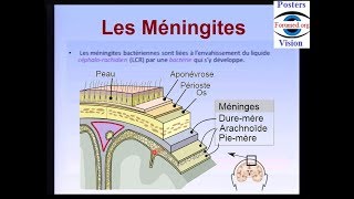 Méningite bactérienne cérébro spinale maladie infectieuse [upl. by Suilmann254]