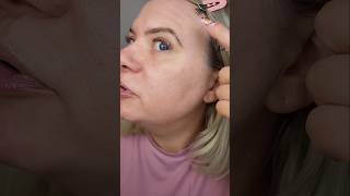 4 WEEK HYPOCHLOROUS ACID UPDATE 🤗 hypochlorousacid skincare skincareroutine skincare101 [upl. by Haerdna354]