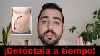 7 señales de que tu dolor de abdomen es apendicitis [upl. by Natty]