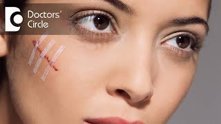 How to get rid of scars on face  Dr Aruna Prasad [upl. by Lilli]