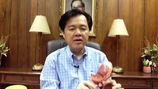 Stomach Ulcer and Hyperacidity Dr Willie Ong Health Blog 24 [upl. by Shayne968]