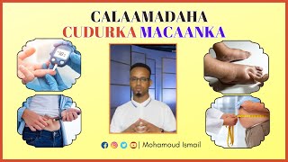 Calaamadaha Cudurka MacaankaSonkorwga [upl. by Eerased978]