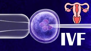 In Vitro Fertilization IVF  What Is IVF Steps How It Is Being Done And success Rates Of IVF [upl. by Nellak]