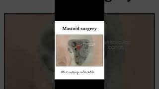 Mastoid surgery procedureanatomy reels hearttouching study youtube ytshorts ytviral [upl. by Attenoj895]