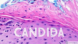 Candida Yeast Infection under microscope Candidiasis Dermatology Dermatopathology [upl. by Pearlman]