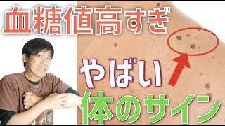 血糖値が高いことを教えてくれる１０個の体の警告 [upl. by Profant]