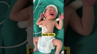 Newborn reflex  newborn assessment  primitive reflexes startle reflex youtubeshortsviralvideo [upl. by Stanwinn]