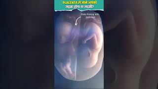 PLACENTA से जाने आपको लड़का होगा या लड़की [upl. by Alcinia]