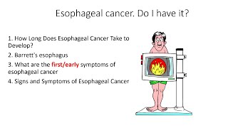 Esophageal cancer How Long Does Esophageal Cancer Take to Develop [upl. by Robinetta524]