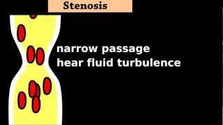 Heart Murmurs Easy Cardiac Auscultation Tutorial Intro Aortic Stenosis Regurgitation 3 of 5 [upl. by Aidnic716]