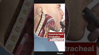 ENDOTRACHEAL INTUBATION ANIMATION 3d animation intubation shorts life icu medicalstudent [upl. by Annaigroeg]