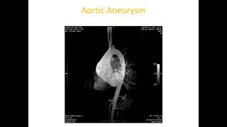 Cardiac MRI and CT imaging Cardiology heart HRCT americancollegeofcardiology [upl. by Asilrahc]