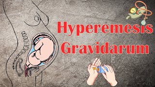 Hyperemesis Gravidarum  Causes Signs amp Symptoms Diagnosis amp Treatment [upl. by Annekam605]