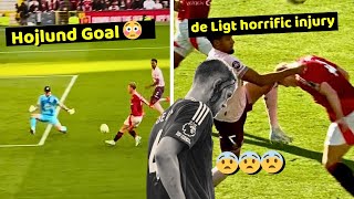 Matthijs de Ligts horrific injury moment in Manchester United Vs Brentford 21 [upl. by Aleetha]