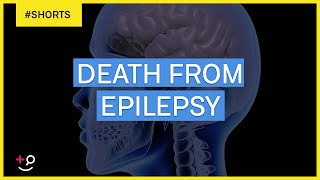 Can You Die From Epilepsy Shorts [upl. by Erelia]