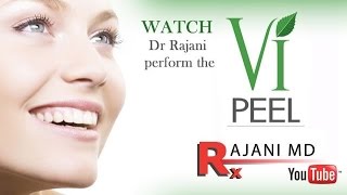 Vi PEEL  Watch it Applied Explained Dr Rajani [upl. by Ahiel]