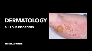 PEMPHIGUS VULGARIS  BULLOUS PEMPHIGOID  بالعربي [upl. by Eenrahc730]