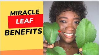 8 Benefits of Miracle leaf leaf of lifebryophyllum pinnatum  uses [upl. by Kirtley]